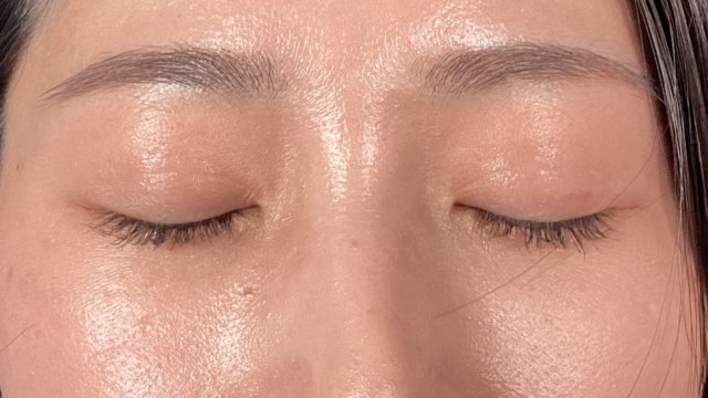 Postoperative Condition Part 1