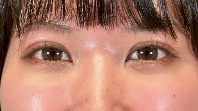 Postoperative Condition Part 1