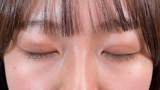 Postoperative Condition Part 1