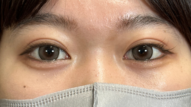 Postoperative Condition Part 1