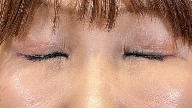 Postoperative Condition Part 1