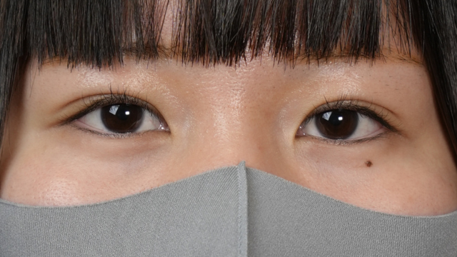 Postoperative Condition Part 1