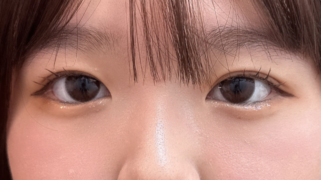 Postoperative Condition Part 1