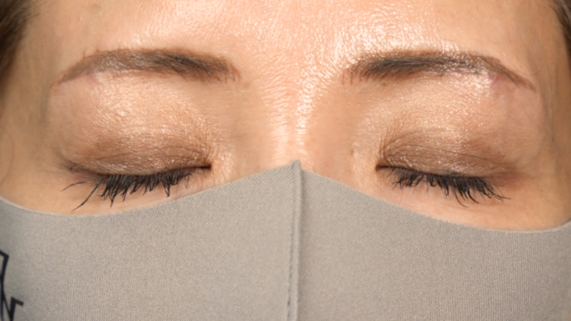 Postoperative Condition Part 1