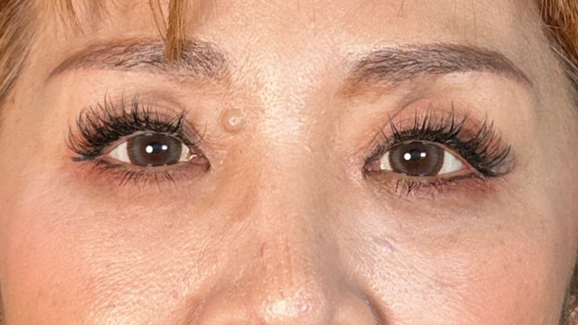 Postoperative Condition Part 1