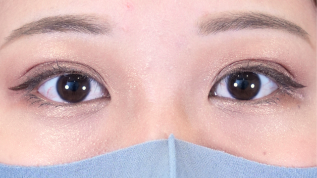 Postoperative Condition Part 1