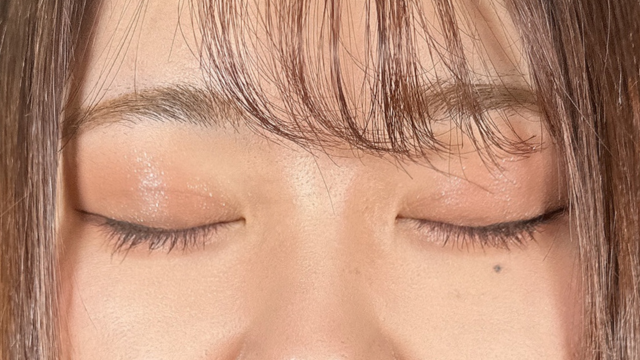 Postoperative Condition Part 1