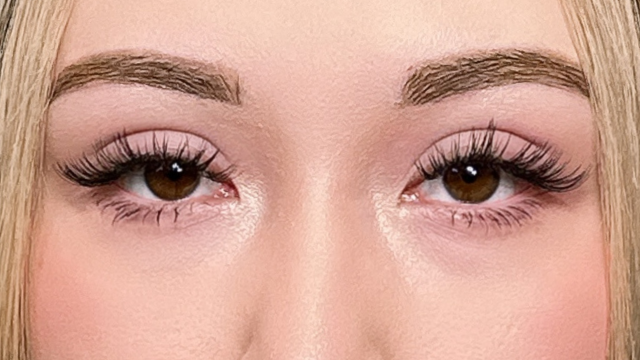 Postoperative Condition Part 1