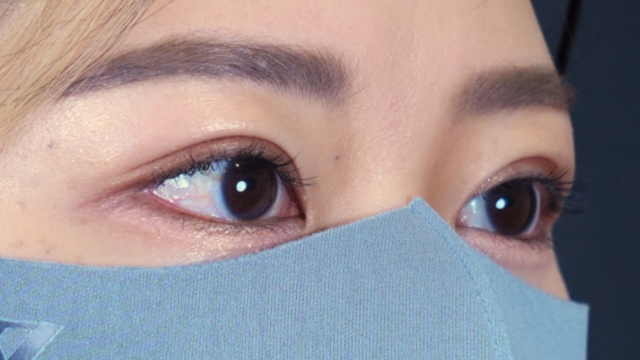 Postoperative Condition Part 1