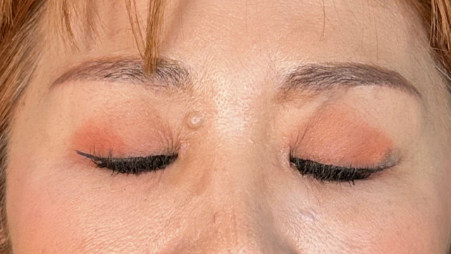 Postoperative Condition Part 1