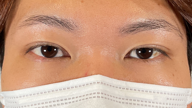 Postoperative Condition Part 1