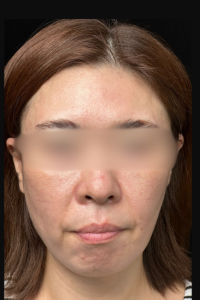 Postoperative Condition Part 1