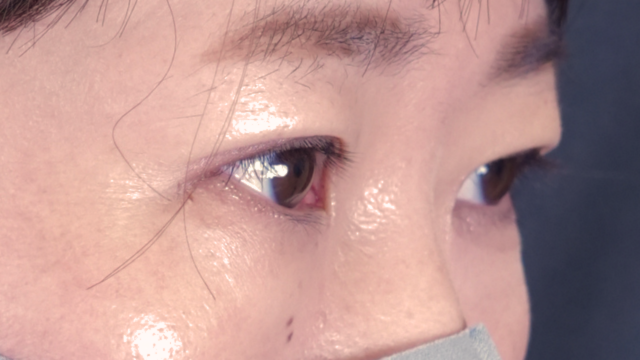 Postoperative Condition Part 1