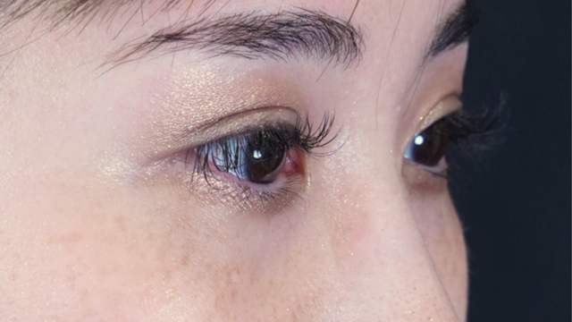 Postoperative Condition Part 1