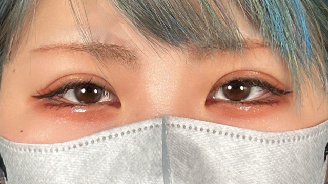 Postoperative Condition Part 1