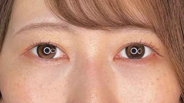 Postoperative Condition Part 1