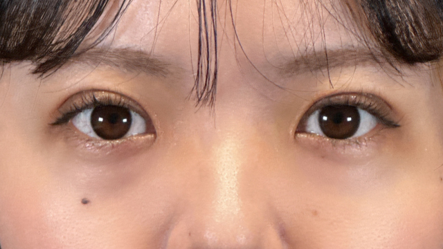 Postoperative Condition Part 1