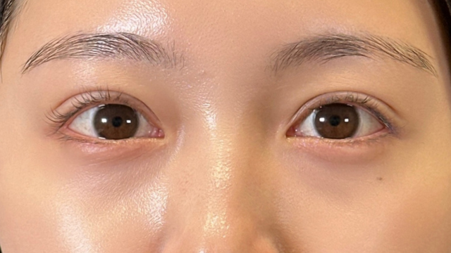 Postoperative Condition Part 1