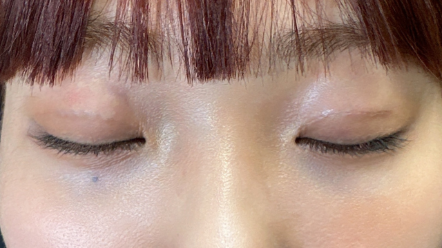 Postoperative Condition Part 1