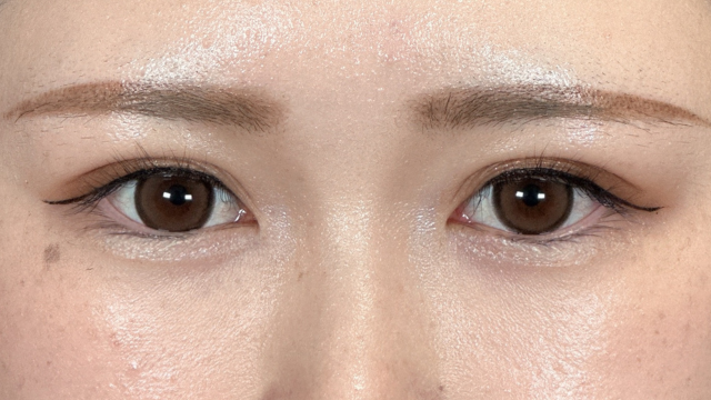 Postoperative Condition Part 1