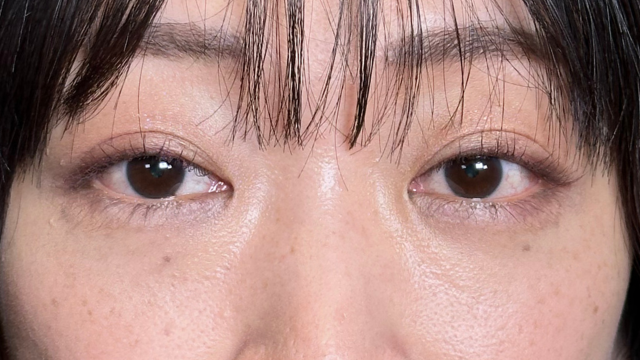 Postoperative Condition Part 1