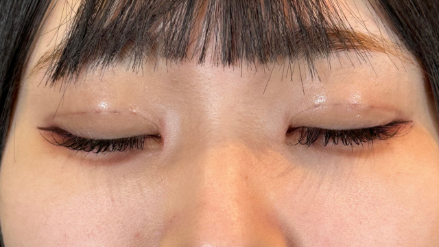 Postoperative Condition Part 1