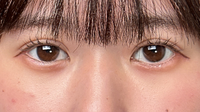 Postoperative Condition Part 1