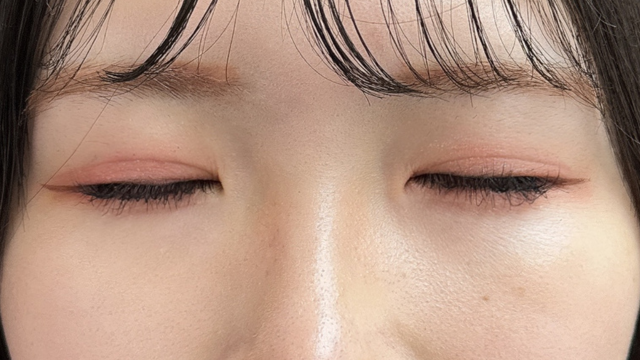 Postoperative Condition Part 1