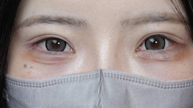 Postoperative Condition Part 1