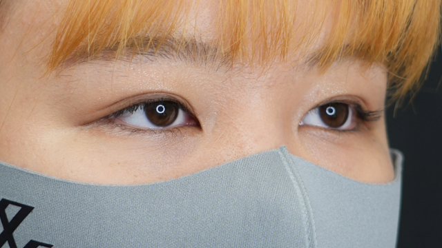 Postoperative Condition Part 1