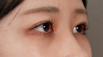 Postoperative Condition Part 1