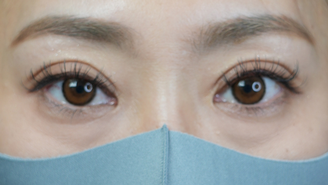 Postoperative Condition Part 1