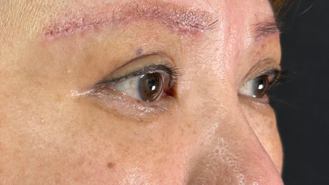 Postoperative Condition Part 1