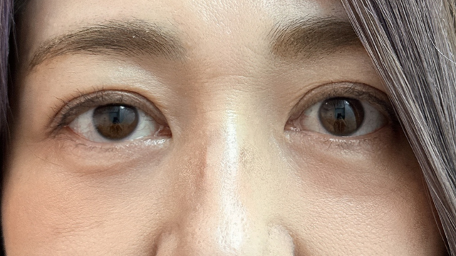 Postoperative Condition Part 1