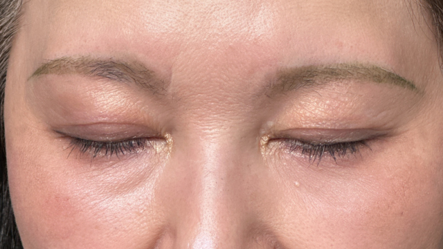 Postoperative Condition Part 1