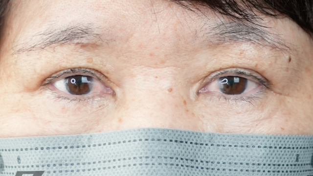 Postoperative Condition Part 1