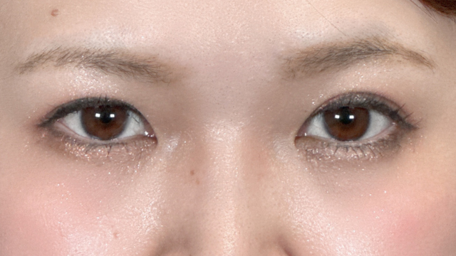 Postoperative Condition Part 1