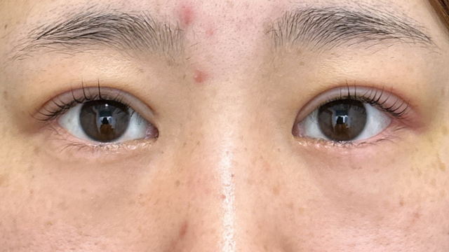 Postoperative Condition Part 1