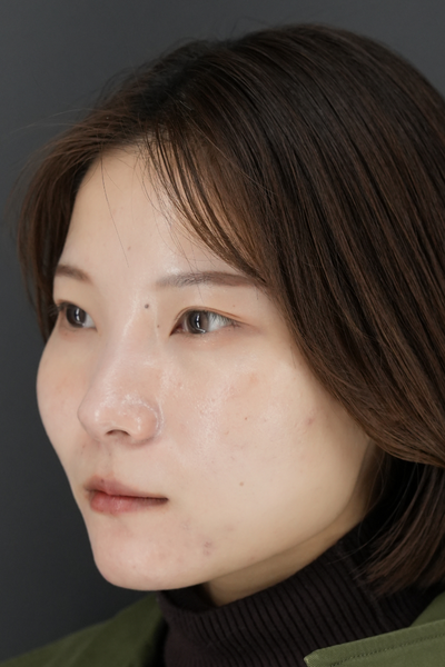 Postoperative Condition Part 1