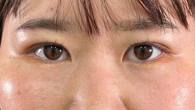 Postoperative Condition Part 1