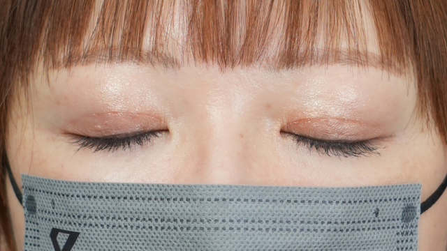 Postoperative Condition Part 1