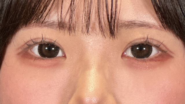 Postoperative Condition Part 1