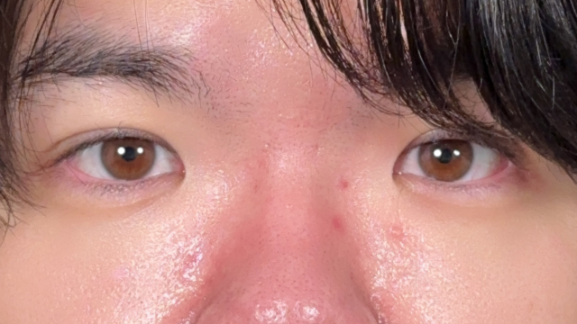 Postoperative Condition Part 1