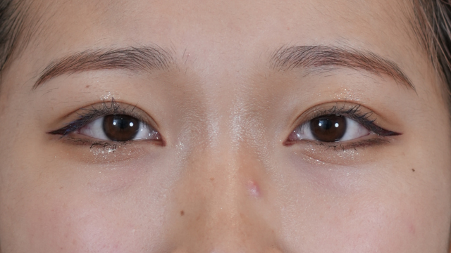 Postoperative Condition Part 1