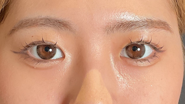 Postoperative Condition Part 1