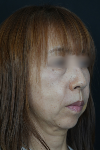 Postoperative Condition Part 1