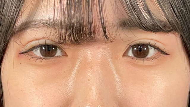 Postoperative Condition Part 1