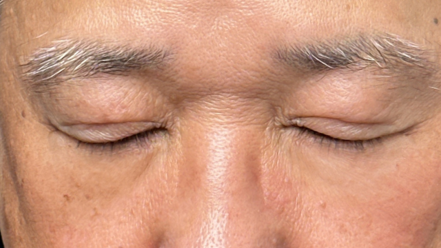 Postoperative Condition Part 1