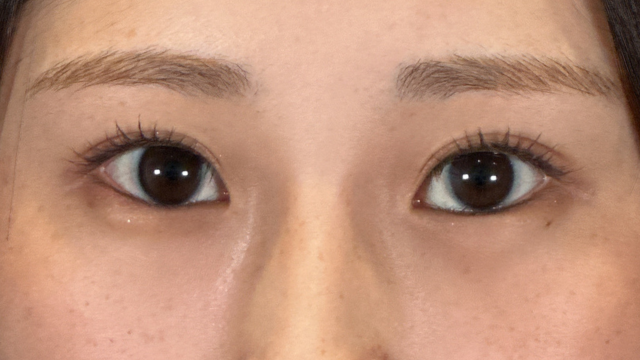 Postoperative Condition Part 1