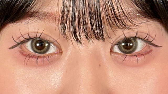 手術後の状態 その1